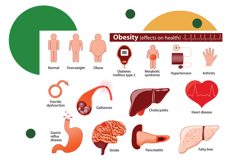 Obesity/Weightloss
